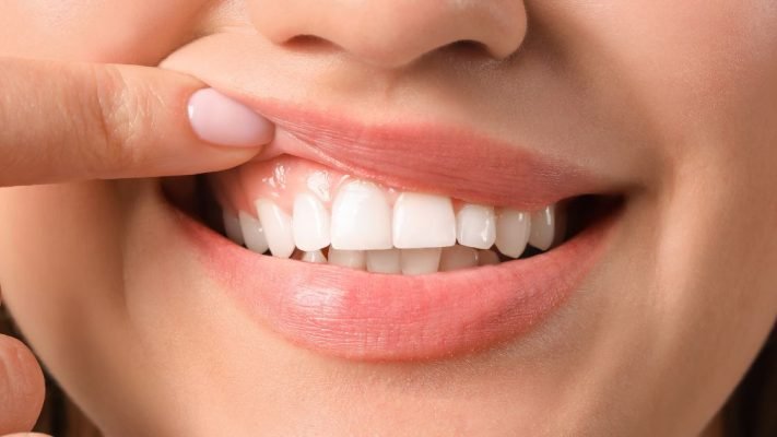 gum disease treatment cost singapore
